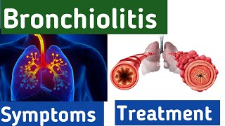 Bronchiolitis breathing  bronchiolitis cough symptoms causes diagnosis and treatment bronchitis [upl. by Francisca]