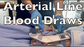 Drawing Blood from an Arterial Line [upl. by Anasus]