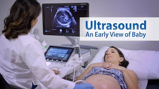 ULTRASOUND An Early View of Baby [upl. by Ahgiel]