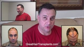 Dr Brett Bolton Hair Restoration Techniques For Men And Women In Lakeland Florida [upl. by Htide]