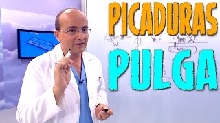 PICADURA DE PULGA ¿Cómo son ¿Qué síntomas producen ¿Cómo hay que actuar ¿Cómo Prevenirlas [upl. by Leandra711]