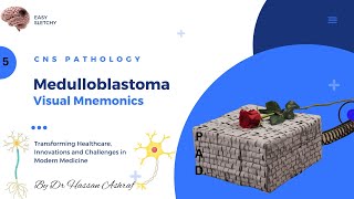 Medulloblastoma Pathology  Visual Mnemonics  Morphology  CNS Pathology  NEET PG USMLE MBBS [upl. by Jacinta]