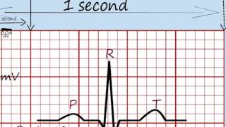 Ekg Okuma1 [upl. by Akemit66]