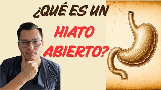 ¿QUE ES HIATO ABIERTO [upl. by Calla]