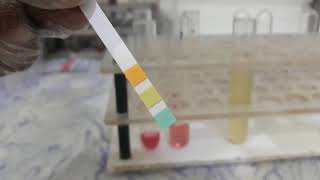 Urine Albumin Test [upl. by Maxma]