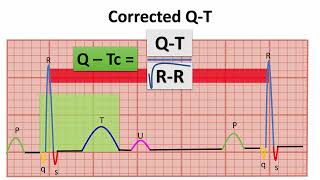 WHAT DO YOU KNOW ABOUT QTc INTERVAL quotNORMAL ECG VALUESquot  NARCOSIS😴🤤 [upl. by Grissom]