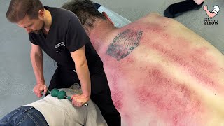 Chiropractor PUTS Full Weight 😳 Into Mans Back To Loosen Tight Joints  Gua Sha amp A CRUNCHY NECK [upl. by Nasia]