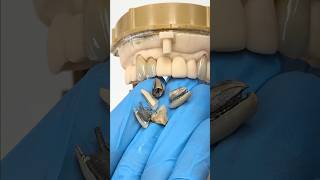 Replacing Shattered Ceramics EnvisiontecMain envisiontec lsk121shorts teethsmile dental [upl. by Shirleen]