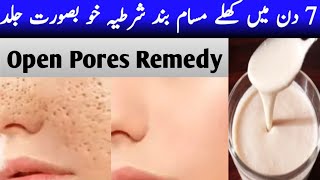 Skin Repair  Close Large OPEN PORES in1 weekRemove Dark Spot Anti Aging pores [upl. by Hanauq]