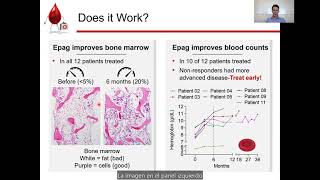 FA Connect Eltrombopag Clinical Trial Update 2022 [upl. by Isidora]