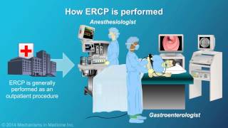 Understanding ERCP Endoscopic Retrograde Cholangiopancreatography [upl. by Hanahsuar98]