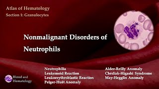 Nonmalignant Disorders of Neutrophils [upl. by Ardnassac]