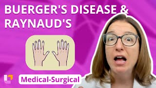 Buergers Disease and Raynauds  MedicalSurgical  Cardiovascular System  LevelUpRN [upl. by Dimond695]