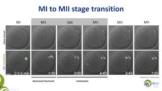 The importance of being mature Oocyte maturity assessment in clinical practice [upl. by Anirtac283]