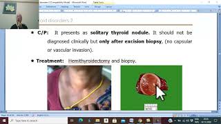 Thyroid disorders in Arabic 18  Thyroid neoplasms  pathology 1   by Dr Wahdan [upl. by Naujet]