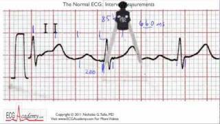 Interval Practice 65  ECG  EKG Interpretation  BASIC [upl. by Schwinn481]