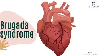 What is Brugada Syndrome  Signs symptoms test and treatment  Cardiac Rhythm [upl. by Yram]