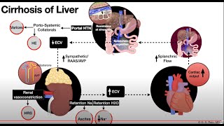 LiverCirrhosisAscites1cPathophysiology [upl. by Hale]