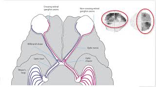 RS Vision Pathway Part 4  Chiasmal Segment [upl. by Polad]