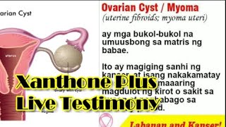 Ovarian Cyst MyomaXANTHONE PLUS Live Testimony [upl. by Gallenz]