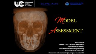 MODEL ASSESSMENT IN ORTHODONTICS  ANALYSIS OF MIXED DENTITION MODELS IN ORTHODONTICS [upl. by Llenna393]