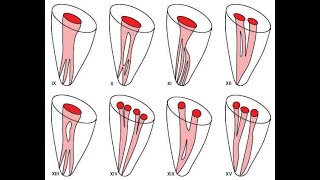 Most Important 4 Classifications of Root Canal Systems [upl. by Sonitnatsnok]