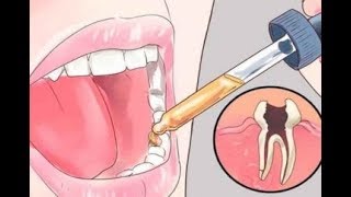 12 All Natural Toothache Remedies Your Dentist Doesn’t Want You to Know About [upl. by Feetal643]