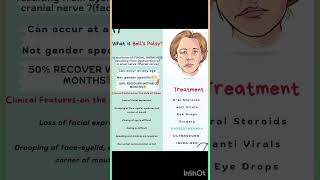 Bells Palsy Facial Paralysis shortvideoshortfeed [upl. by Gnaht]