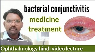 bacterial conjunctivitis  medicine treatment  conjunctivitis in eye  ophthalmology hindi [upl. by Lerret]