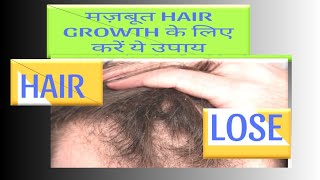 Minoxidil Finasteride topical solution hair growth results Hair regrowth diet [upl. by Moitoso]