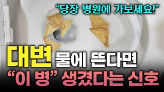 이런 대변 대장암의 신호일 수 있습니다 대변 모양으로 내 건강 상태 확인하는 법 변기에 뜨는 변 혈변 변비 묽은 변 토끼 똥 [upl. by Mariand]