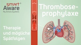 Thromboseprophylaxe Therapie und mögliche Spätfolgen  Fachfortbildungen in der Pflege  smartAware [upl. by Anilat144]