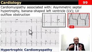 internalmedicine cme usmle محاضراتباطنة ecg كورساتباطنة clinical clinical medicine [upl. by Emalia859]