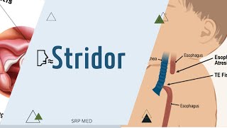 StridorDefinitionTypesMechanism [upl. by Gnourt735]