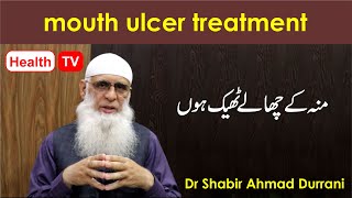 mouth ulcer causes and treatment [upl. by Anirret510]