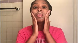 Glycolic Acid Peel DIY  Dark Spot Treatment [upl. by Sad]