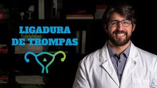 Ligadura de Trompas I Dr Ego [upl. by Dierdre]