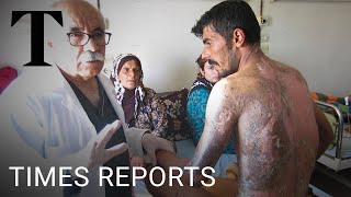 Exclusive evidence of white phosphorus use in Syria  Times Reports [upl. by Lexi]