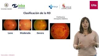 Programa de cribado de retinopatía diabética [upl. by Stefa]