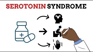 Serotonin Syndrome MADE EASY  Your professor made it too complicated [upl. by Dis]