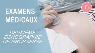 La 2e échographie de grossesse  Examens grossesse [upl. by Alvis604]