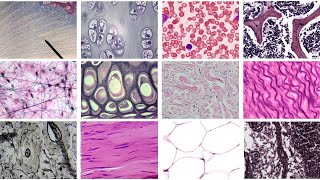 Practice Identifying Connective Tissue Complete [upl. by Llemij]