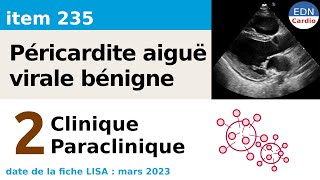 235  Péricardite aiguë  Partie 2  CliniqueParaclinique de la forme aiguë virale bénigne [upl. by Bible]