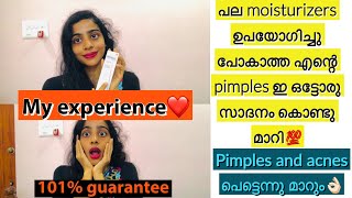 മുഖക്കുരു ഉള്ള face നു പറ്റിയ Moisturizer🔥Moisturizer for acne oily sensitive skin😍 moisturizer [upl. by Glaudia]