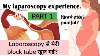 Laparoscopy Experience Part 1  My Laparoscopy Experience in hindi  Blocked Fallopian tube [upl. by Stickney]