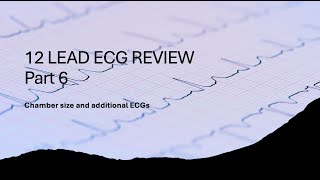 12 Lead Review Part 6 Chamber size and additional 12 lead ECG patterns [upl. by Barnaba657]