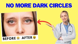 Dark Circles Demystified Your StepbyStep Removal Blueprint  Skin Care Ideas [upl. by Grote]