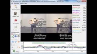 Spinal Analysis 3D segmental protocol in Simi Aktisys [upl. by Riess633]