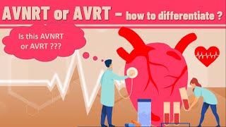 AVNRT VS AVRT  How to differentiate AVNRT from AVRT on ECG  definition ECG findings and examples [upl. by Vallonia268]