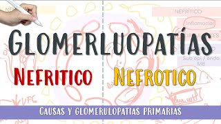 GLOMERULOPATIAS Nefrotico Nefritico GNRP Membranosa GNPE FocalySegmentaria Glomerulonefritis [upl. by Laertnom]